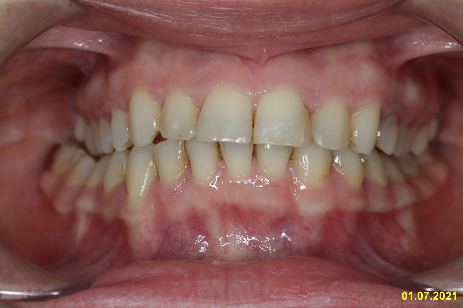 Clinical front view