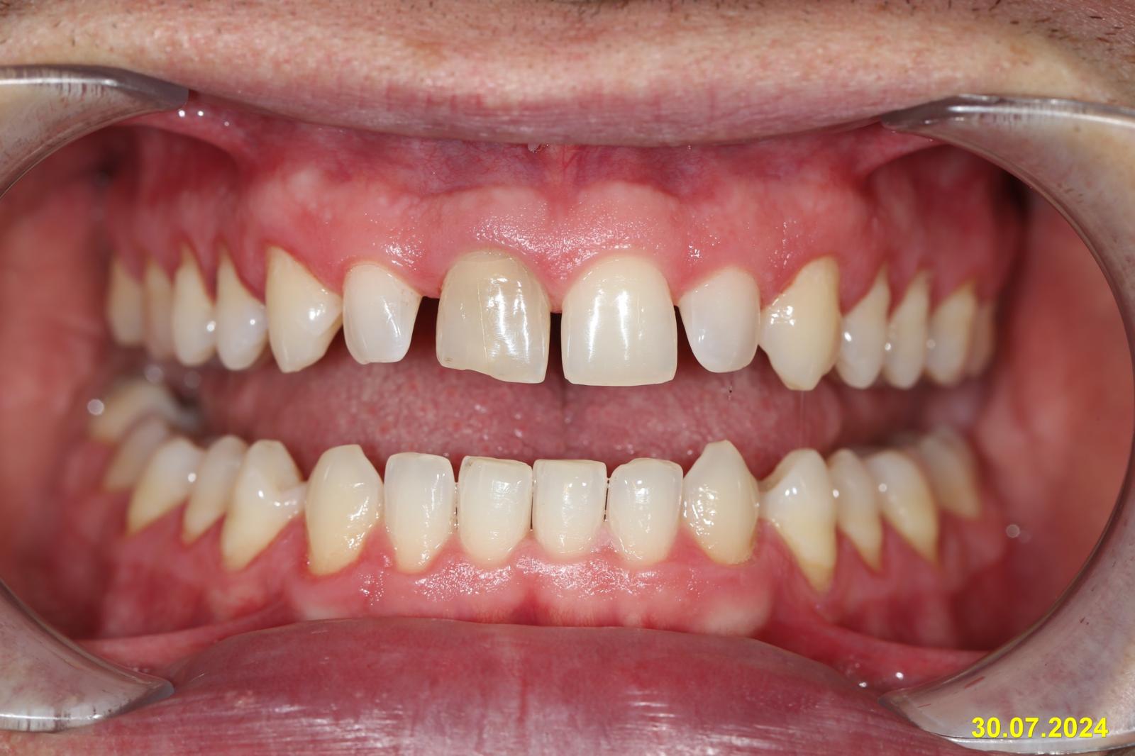 Clinical detail