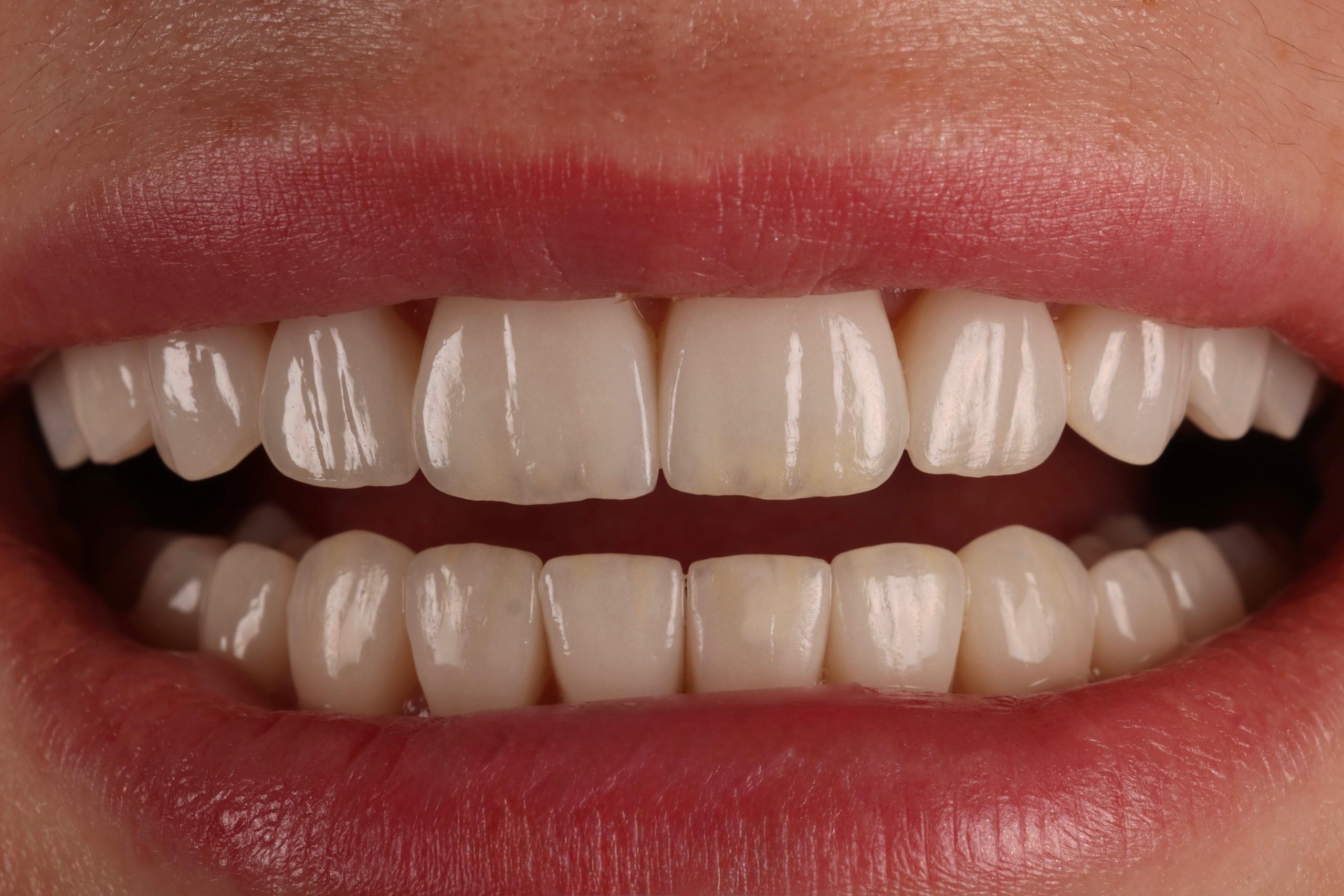 Smile detail