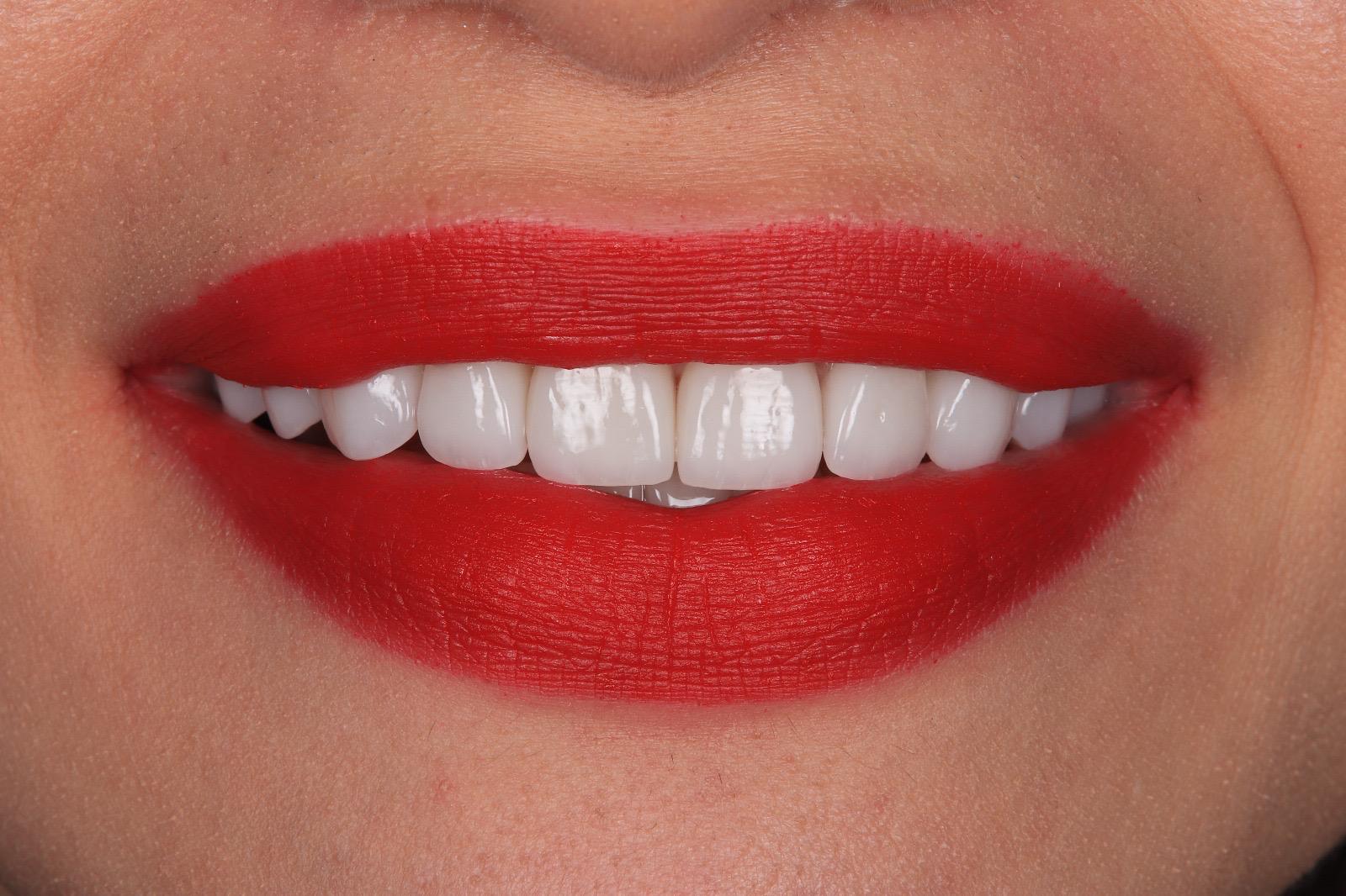 Smile detail